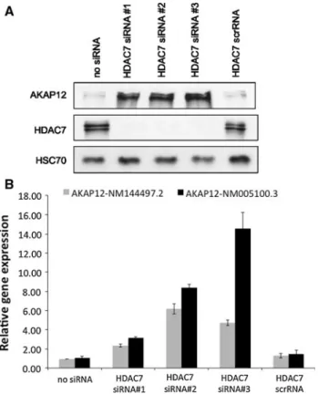 Fig. 1 HDAC7 silencing modulates AKAP12 gene- and protein- protein-expression levels. a Western blot analysis of AKAP12 protein expression in HUVECs following the depletion of HDAC7