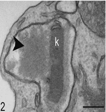 Fig. 2: Figure 2: Transmission electron microscopy  of parasite treated with 20 µM berenil for 48 hours