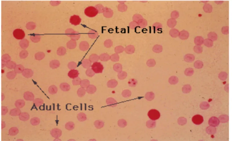 Fig.   1   :   frottis   sanguin   pour   le   calcul   du   test   de   Kleihauer   