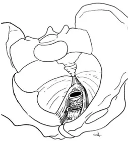 Fig n°14. Le faisceau pubo-rectal soutient la vessie, le vagin, le rectum [8] 