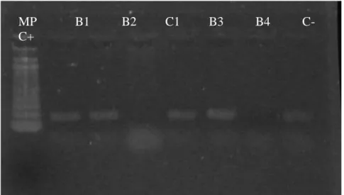 Fig. 3 374  375  376  MP            B1          B2         C1         B3          B4          C-            C+   eri locus   Tandem IS711 