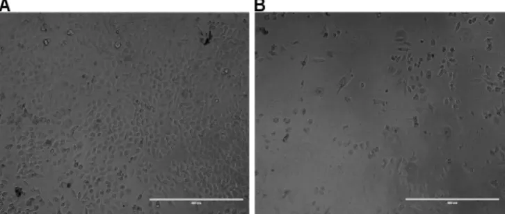Figure 1.  Confocal microscopy images of SiHa cells treated with empty liposomes (A), lipoplexes (B) and lipoplexes with 30% of DSPE-PEG 2000  (C)