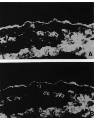 Fig. 1. Normal human skin. Double immunofluorescent localization of human BM using human antibody to laminin purified from serum of eclamptic patients, A, or rabbit antibody purified from antiserum of rabbits immunized against mouse laminin, B (x 64).