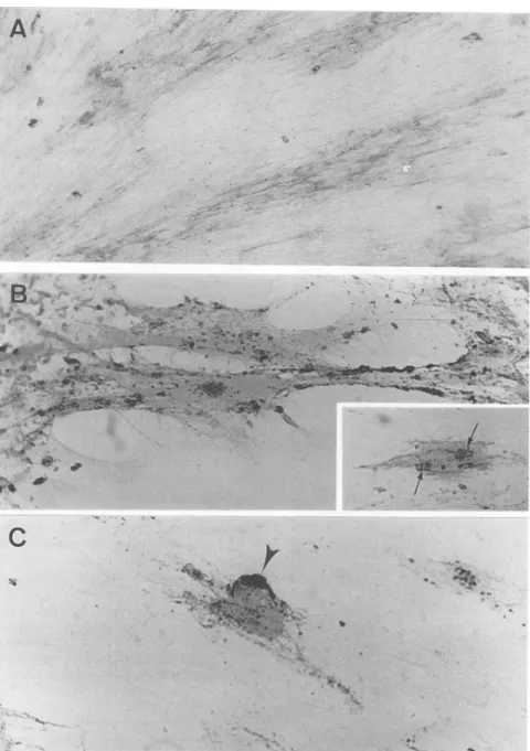 FIG. 2. Detection of antigen-antibody complexes on the surface of VZV-infected cells cultured with anti-VZV human antibodies for 2 h (transient immunomodulation)