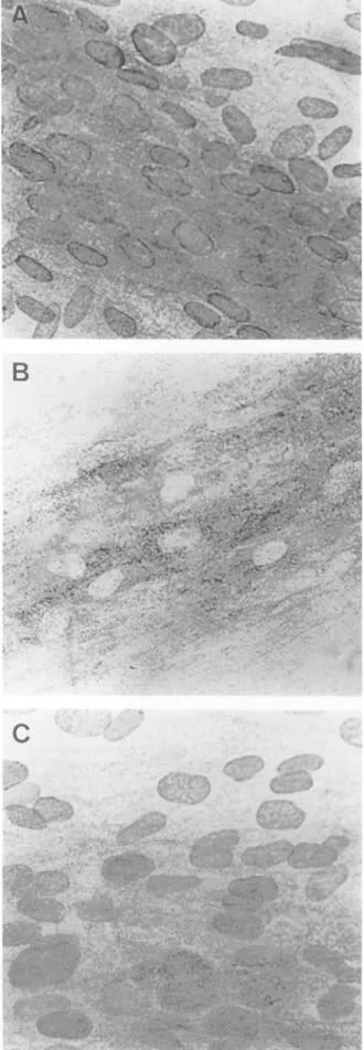 FIG. 3. Immunoperoxidase labeling of viral antigen with a mono- mono-clonal antibody (Biosoft 215-84/101) on VZV-infected cells