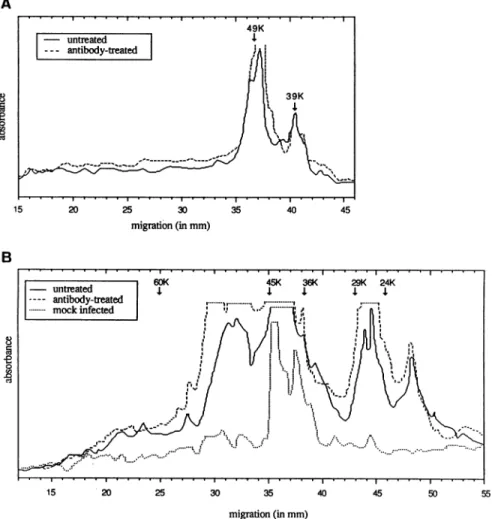 FIG. 5. Electrophoretic profile of viral antigens revealed after Western blotting. Cells were cultured without or with anti-VZV human antibodies during 48 h and then recovered