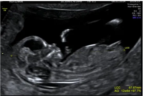 Figure 1 : Mesure de la LCC selon les critères de qualité 