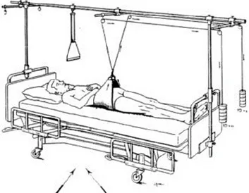 Figure 8 : traitement par hamac 
