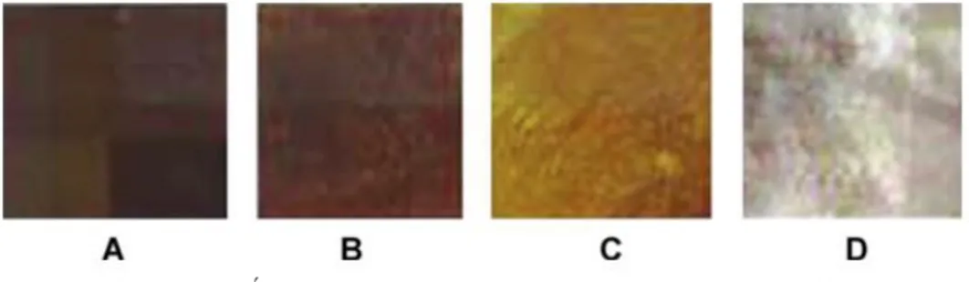 Figure 2 : Échantillons de couleurs de dentines cariées 