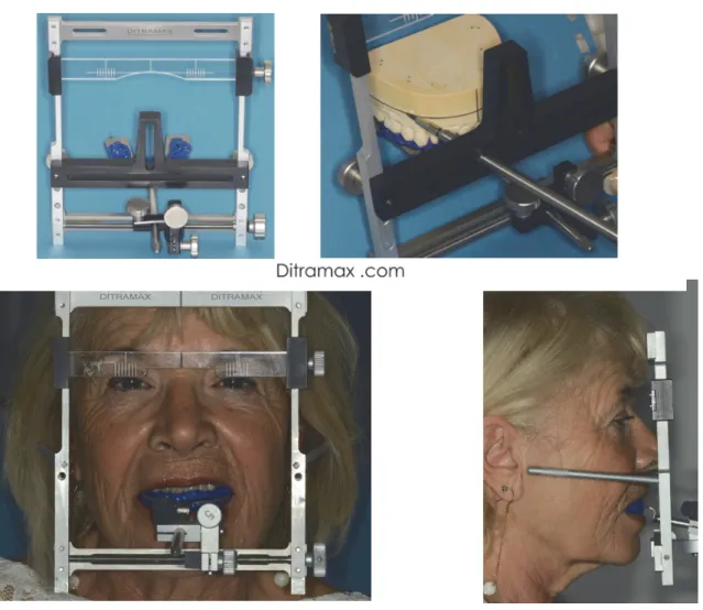 Figure 10: Ditramax ® : utilisation 