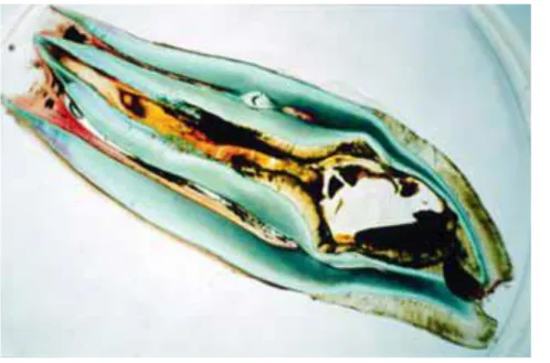 Figure 10 : Image histologique d’une dent invaginée de type III selon Oehlers. La pulpe représente  une enveloppe concentrique de l’invagination (2) 