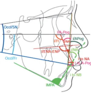 Figure 10: Etude céphalométrique des relations dentosquelettiques [41] 