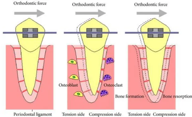 Figure 1 : Le déplacement orthodontique, d’après KITAURA H (65). 