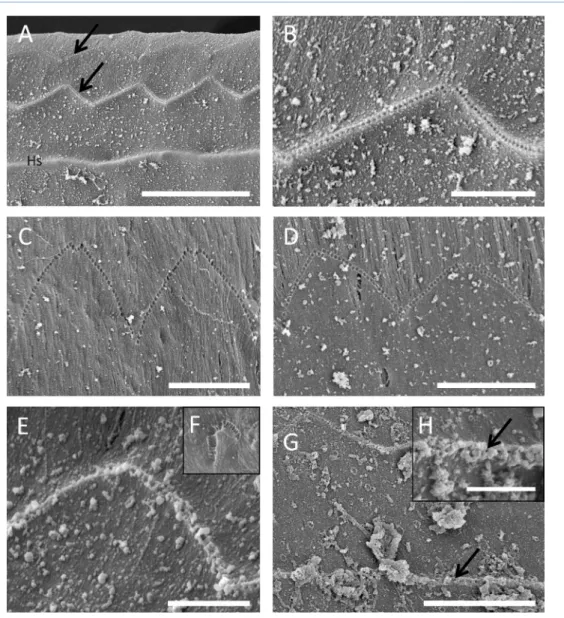 Figure 7. Scanning electron microscopy images of the outer hair cell stereocilia imprints on the undersurface of the tectorial membrane of a striped dolphin (A, arrows, and B), northern bottlenose whale (C), harbor porpoise (D), and common dolphin (E)
