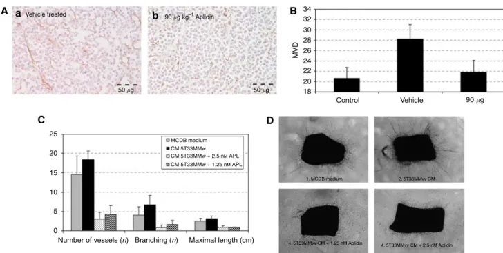 Figure 5 (A) CD31 immunostaining on bone marrow sections. (B) Quantification of microvessel density (MVD)
