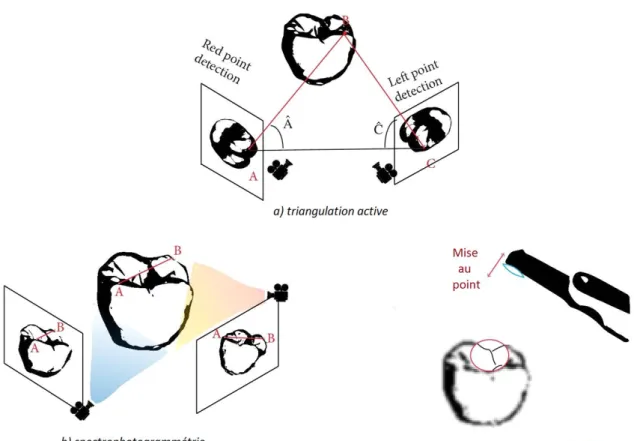 Figure 2 :  les technologies de prise d’empreinte optique (R. Richert et al. (10)) 