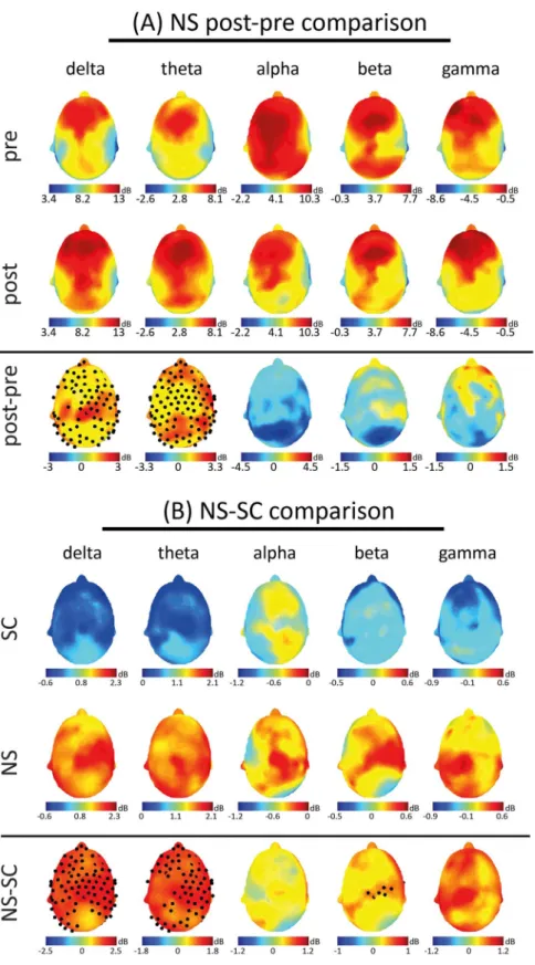 Figure 1. (A) Topographical distributions of mean (among subjects) log-transformed power in the five bands  of interest are presented for the NS