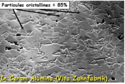 Figure 12 : Microstructurs polycristallines de céramique alumineuse pure de haute  densité et absence de phase vitreuse 
