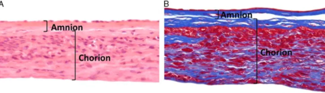 Figure 6: Images histologiques d'allogreffes de membrane amniotique déshydratée (32)  
