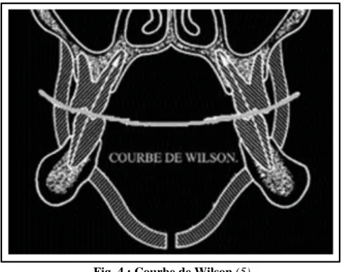 Fig. 4 : Courbe de Wilson (5) 
