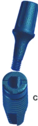 Figure 14 : Implant avec connexion de type cône morse pur 