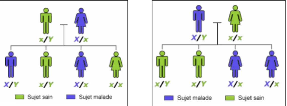 Figure 5  : Schémas d’un mode de transmission dominant lié à l’X (16) 