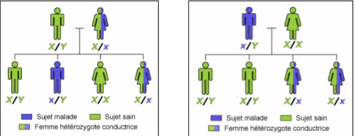 Figure 6  : Schémas d’un mode de transmission récessif lié à l’X (16) 