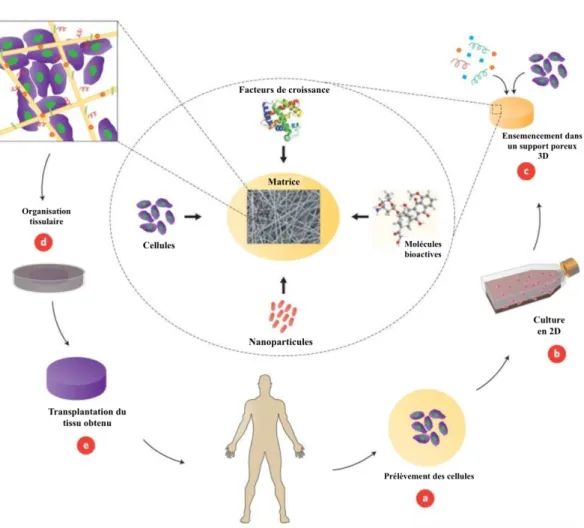 Figure 7 : Exemple d'un concept d'ingénierie tissulaire impliquant des cellules  ensemencées dans un support en biomatériaux poreux (90)