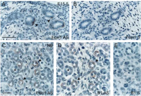 Figure 4. Distribution of Foxi1 and V-ATPase B1 subunit mRNA in mouse developing kidney