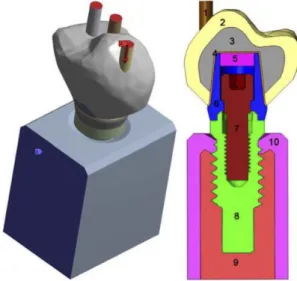 Figure  4 :  Conception  finale  d’un  model  final  3D  représentant  l’os  péri-implantaire  et  un  implant  dentaire  avec  des  cylindres  d’émail  pour  simuler  les  contacts  occlusaux  via  l’analyse  par  éléments  finis, d’après SAROT (68)