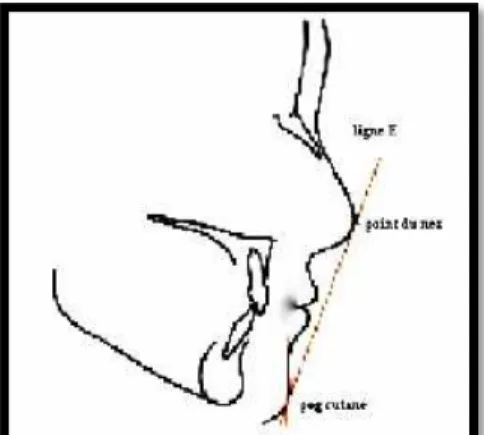 Figure 1 : Ligne Esthétique de Ricketts (61)   