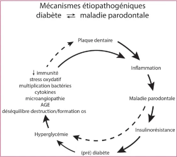 Fig. 5. Mécanismes étiopathogéniques auto-aggravants reliant diabète à maladie parodontale  (79) 