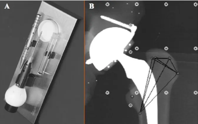 Figure 9 : A : Système de pose des billes de tantale ; B : modélisation du volume 