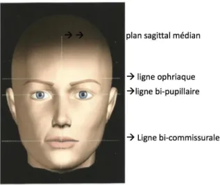 Figure 5 : Les lignes de références horizontales 