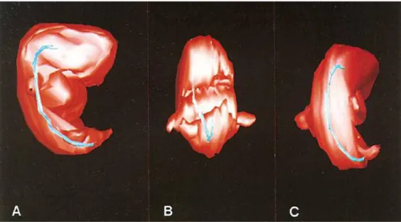 Fig. 8. Représentation tridimensionnelle de la notochorde et de la surface cutanée d’un embryon à 4-5  semaines de gestation – Vues latérale (A), de face (B) et postérieure (C)