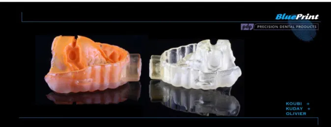 Fig. 6: ces gouttières issues de l’impression 3D assurent un repositionnement unique en bouche grâce à la friction  créée avec le silicone light au niveau des faces vestibulaires et palatines