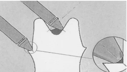 Fig. 15 : manque de précision lors de l’enregistrement des zones anguleuses 