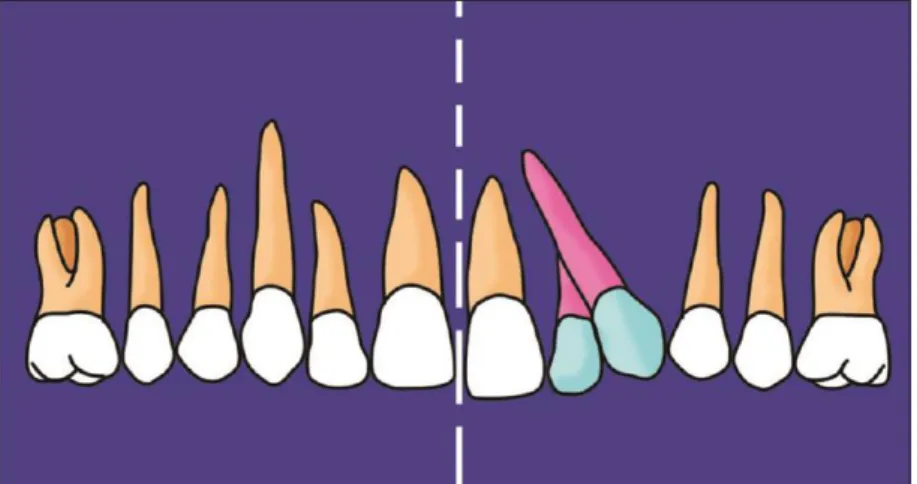 Figure 13 : Classe I type B de RAI 