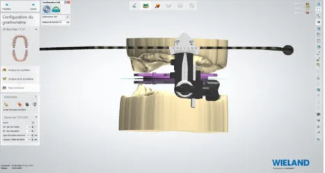 Figure 23 : UTS CAD 