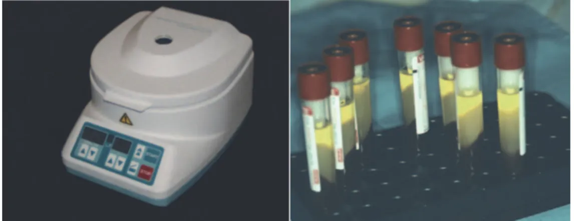 Figure 1 : Centrifugeuse PC02® de Process (photo de gauche) et huit tubes centrifugés  simultanément produisant huit caillots de fibrine PRF