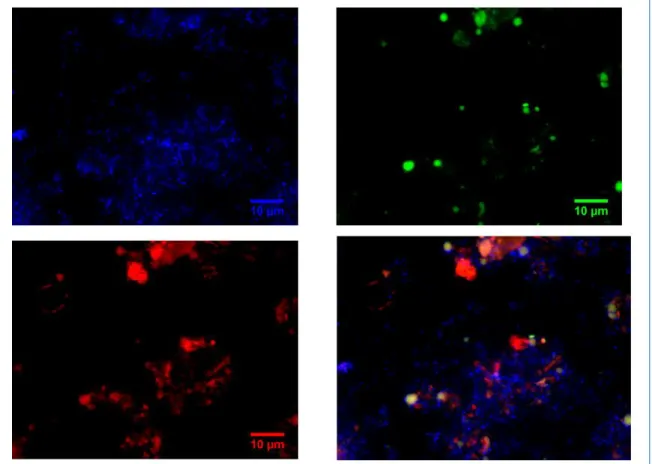 Figure 8 : Fluorescence in situ hybridation pour la détection d’archaea 