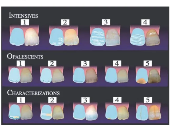 Figure 5 : intensifs, opalescents et caractérisations présentés sur les incisives centrales  maxillaires (11) 