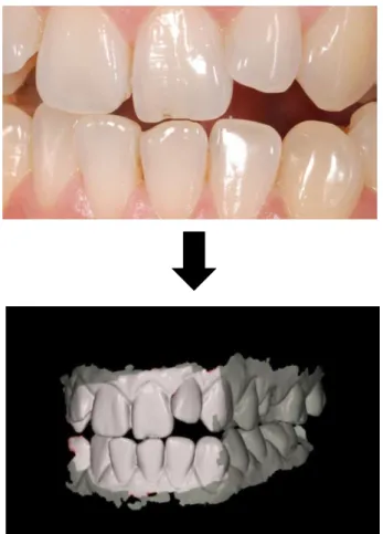 Figure 8 : Numérisation directe (photos du  Dr Soenen)