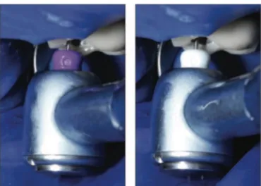 Figure 3 : Lime K 08 et 10 montées sur un moteur M4 (36) 