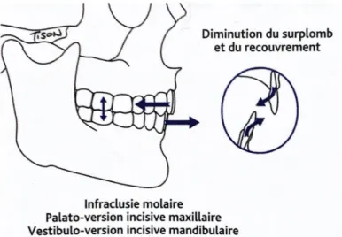 Figure 10 - Modifications dentaires possibles (Cyrille Tison) 