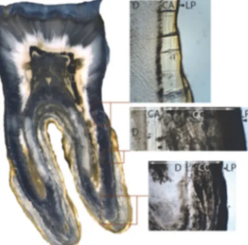 Figure 4- Coupe histologique longitudinale d’une dent humaine avec grossissement des 3 différents   types de cément