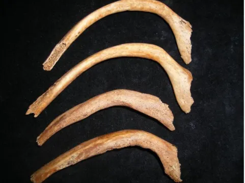 Figure  2  :   Tuméfactions   et   porosités   osseuses   des   côtes   du spécimen FAO90_1296 (3)