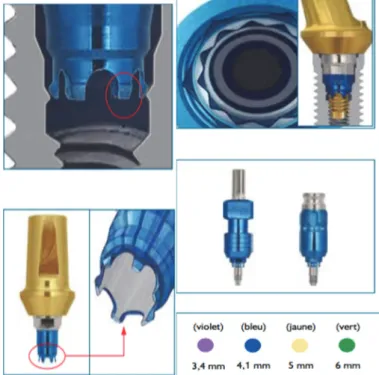 Figure 15 : La connexion QuickSeat ®  sur pilier et sur transfert d’empreinte 