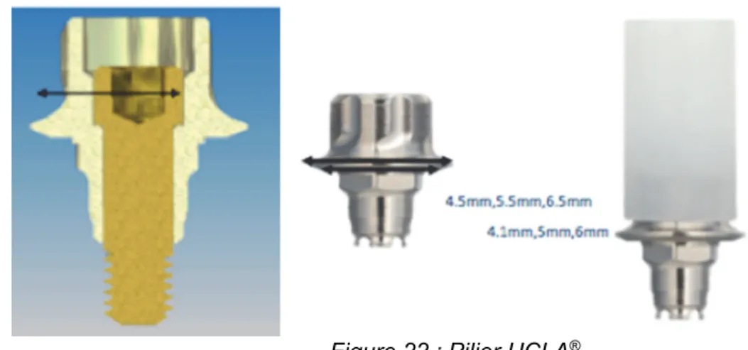 Figure 22 : Pilier UCLA ®