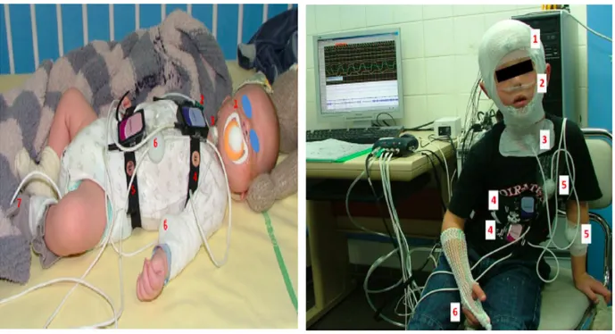 Figure  6 :  Polygraphie  ventilatoire  d’un  nouveau-né d’un mois. (18) 